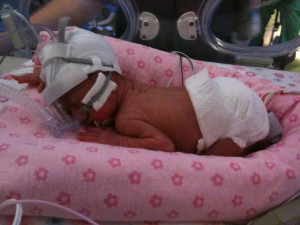 Lilliana (born at 24 weeks, 1lb 12 oz)